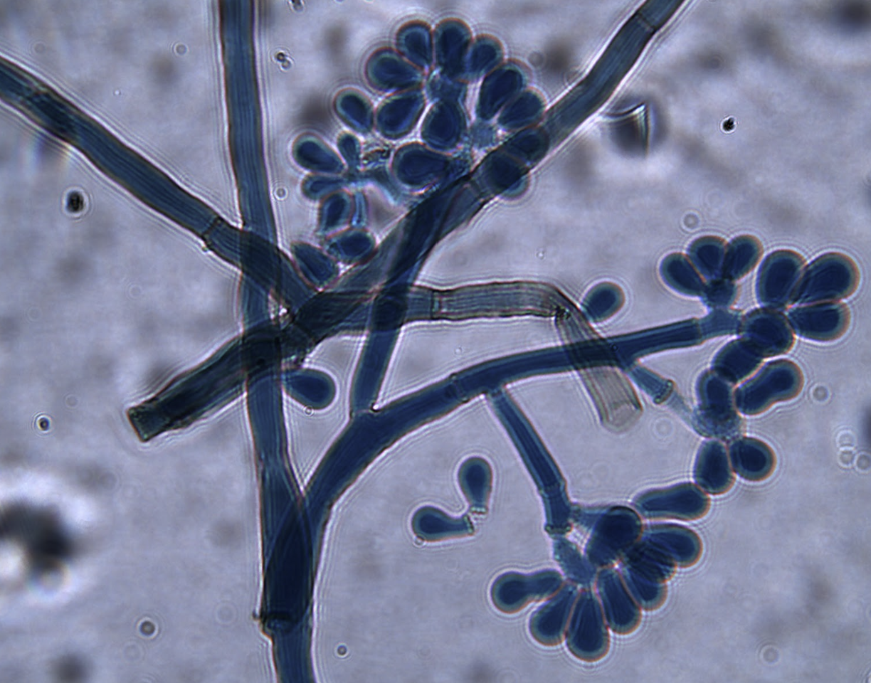 Evaluación de niveles de infección por Botrytis