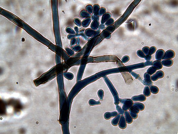 Diagnóstico molecular y sensibilidad a fungicidas